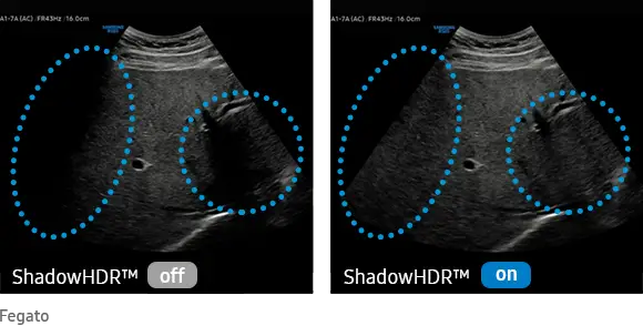 elcamm partner samsung bari Crystal pure shadowhdr