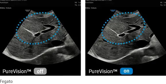 elcamm partner samsung bari Crystal pure vision