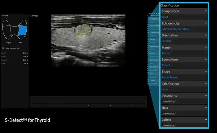 elcamm partner samsung puglia ecografi S Detect Thyroid