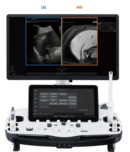 elcamm partner samsung puglia ecografi S Fusion