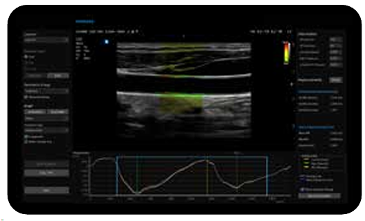 elcamm partner samsung bari ecografi cardiovascolare arterialanalysis