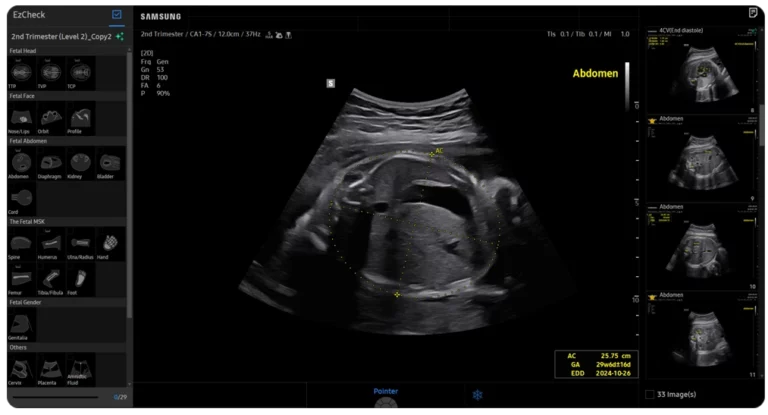 elcamm samsung partner puglia GINECOLOGIA ED OSTETRICIA Live View Assist