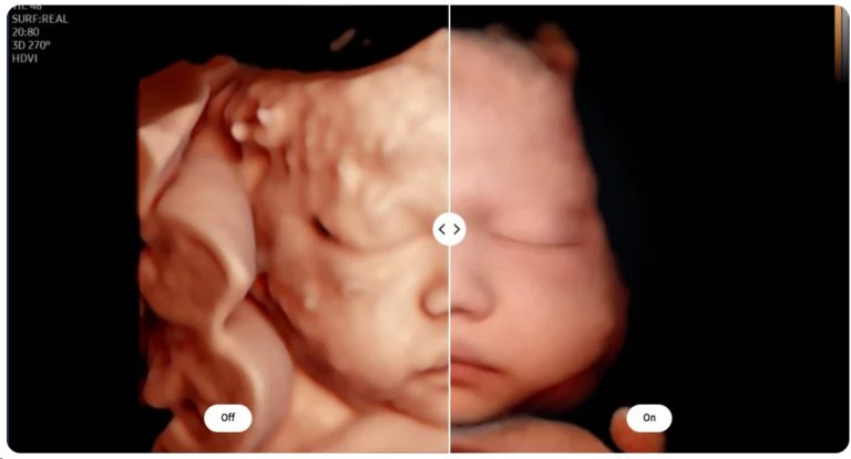 elcamm samsung partner puglia GINECOLOGIA ED OSTETRICIA PortraitVue