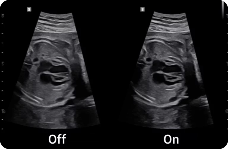 elcamm samsung partner puglia GINECOLOGIA ED OSTETRICIA ezstructure