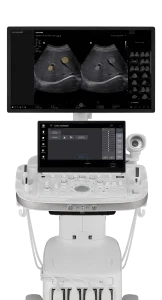 elcamm ecografi PARTNER SAMSUNG philips general imagingremor20